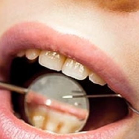 Фотография 1: Эстетическая реставрация центральных зубов